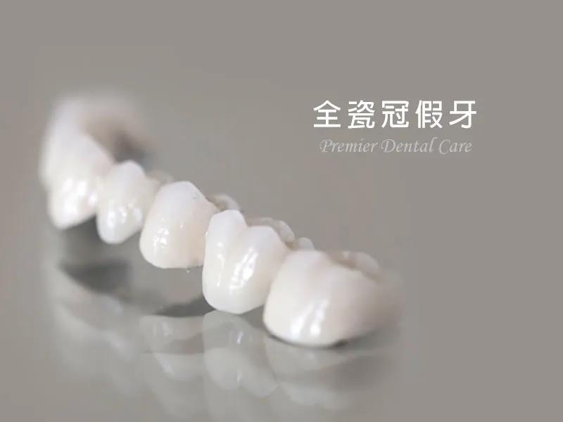 烤瓷牙为何会被全瓷牙淘汰？