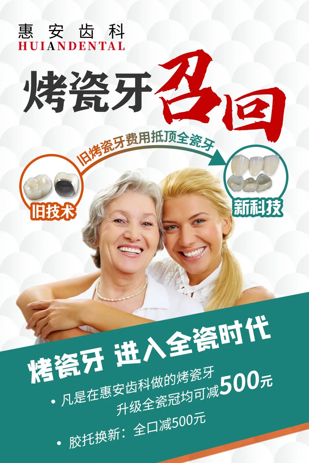 烤瓷牙为何会被全瓷冠淘汰？全瓷冠危害小