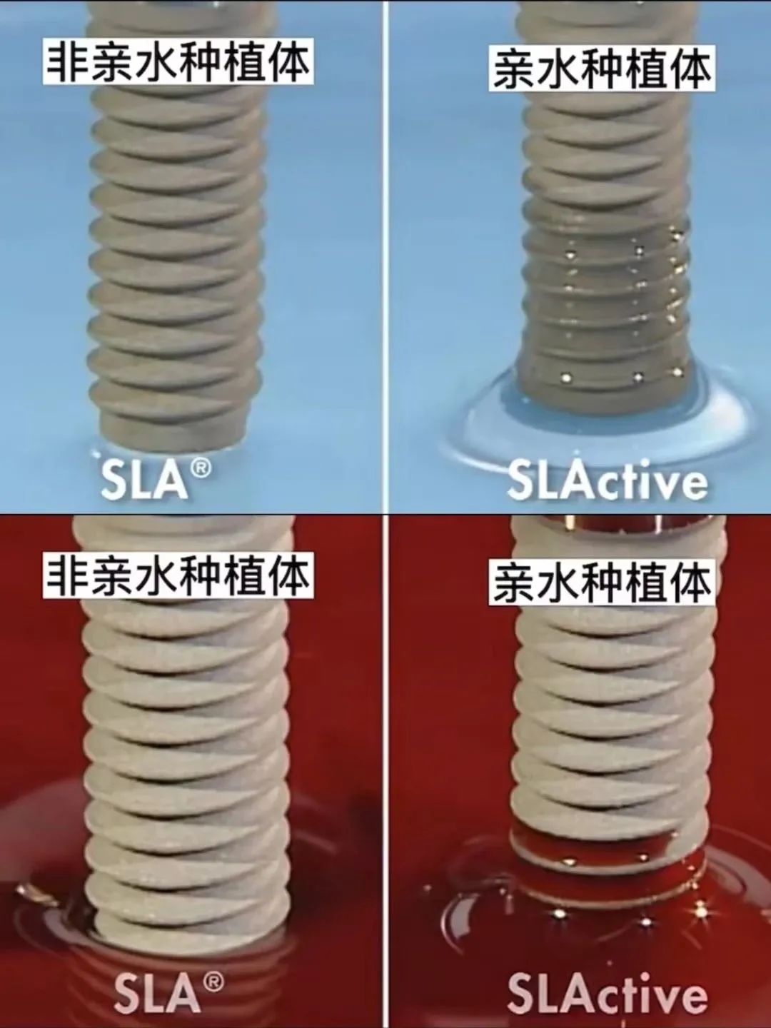 兰州种植牙,兰州种植牙多少钱,兰州种植牙医院,兰州种植牙口腔,兰州口腔,兰州牙科