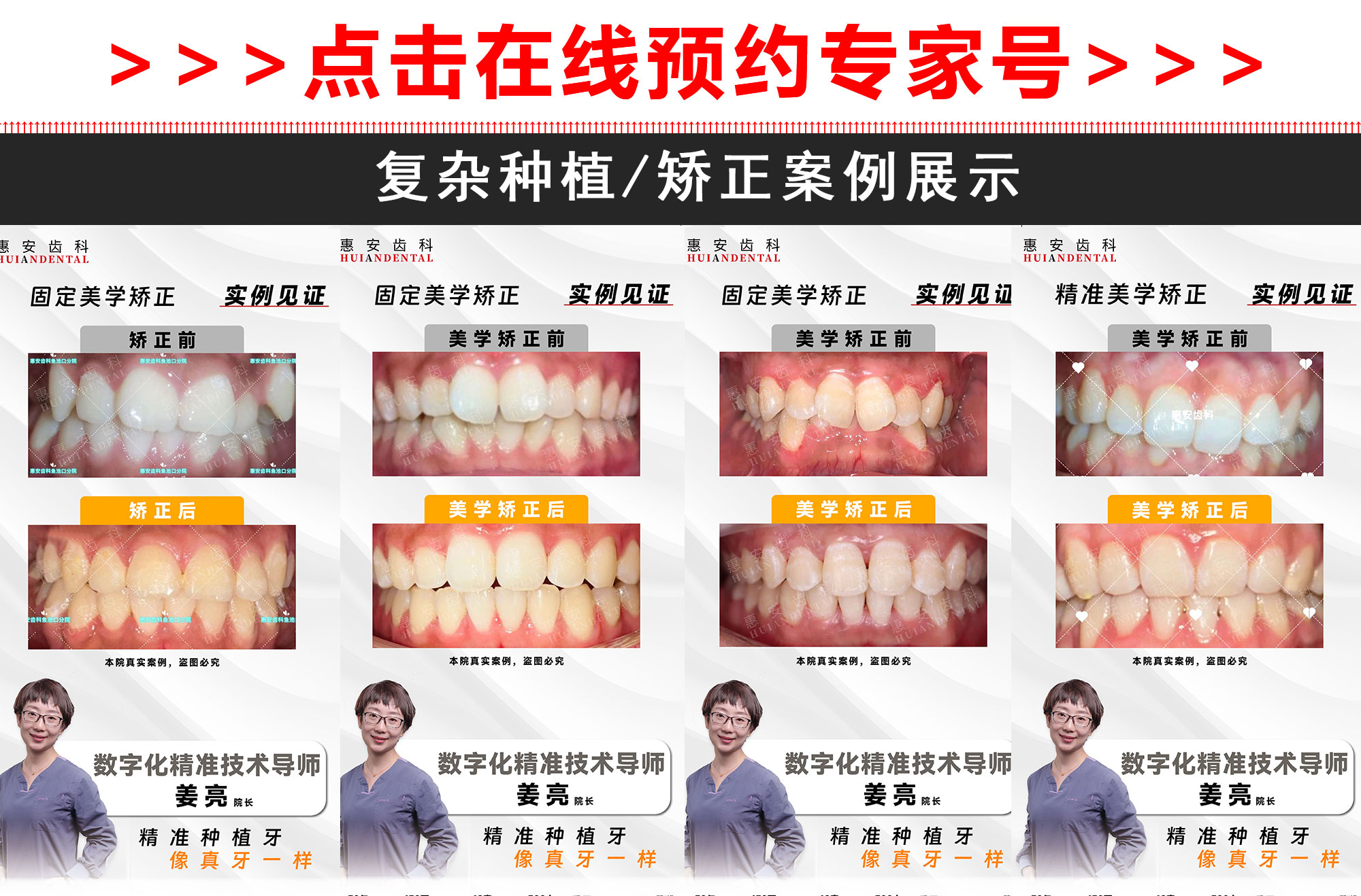 兰州惠安齿科医生，兰州惠安齿科矫正医生，兰州惠安齿科矫正专家，兰州惠安齿科专家