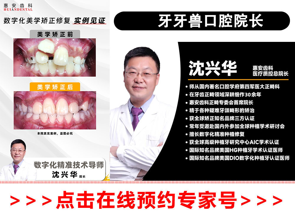 兰州牙齿矫正，兰州矫正牙齿，兰州正畸，兰州牙齿矫正医生，兰州正畸专家