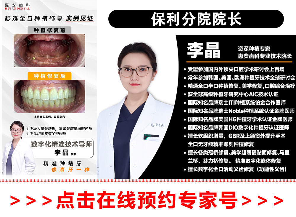 兰州牙科，兰州口腔，兰州种植牙，兰州种植牙，兰州种植牙医院，兰州种植牙口腔