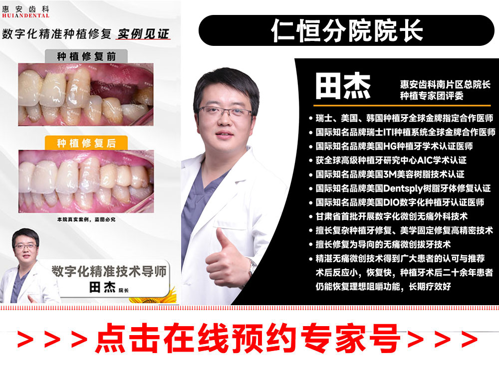 兰州牙科，兰州口腔，兰州种植牙，兰州种植牙，兰州种植牙医院，兰州种植牙口腔
