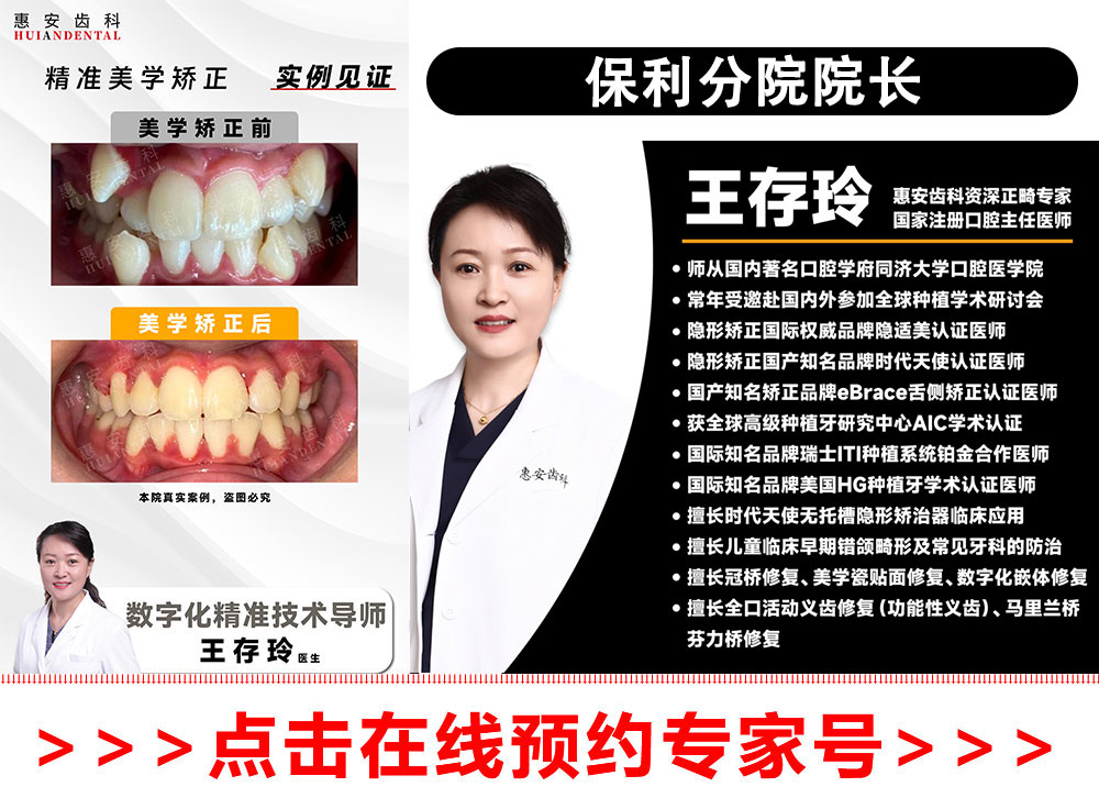 兰州牙齿矫正，兰州牙齿矫正推荐，兰州牙齿矫正医生，兰州正畸，兰州正畸推荐，兰州正畸医生