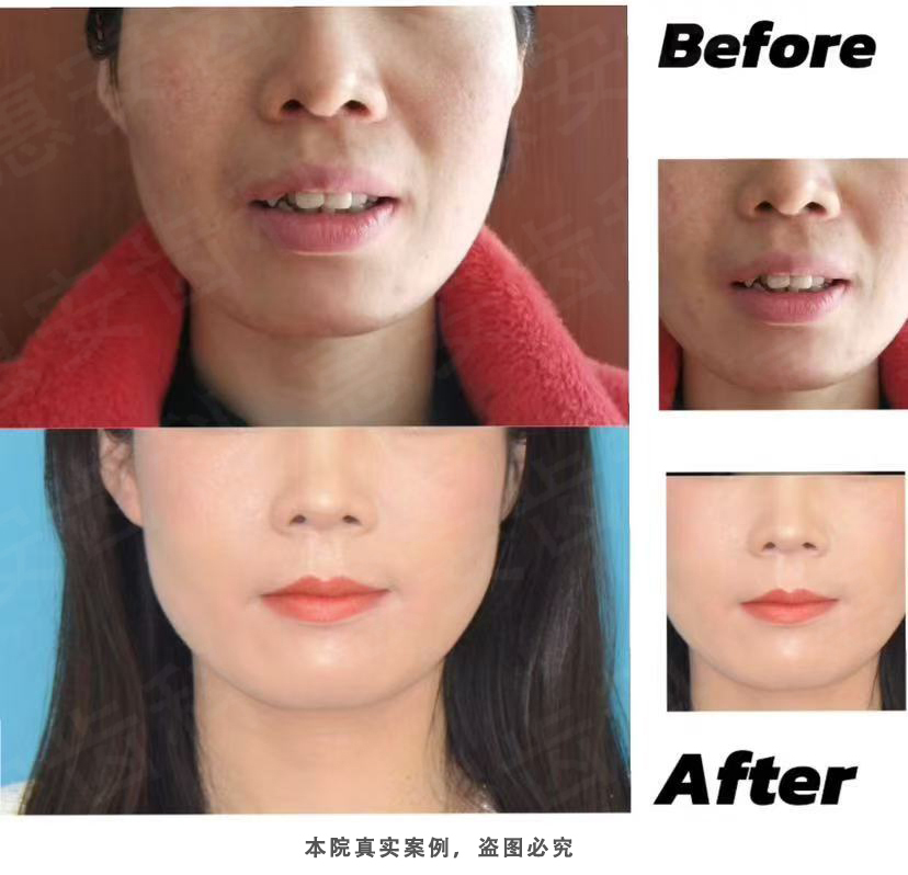 兰州牙科，兰州口腔，兰州矫正牙齿，兰州牙齿矫正，兰州正畸，兰州矫正牙齿哪家好，兰州正畸